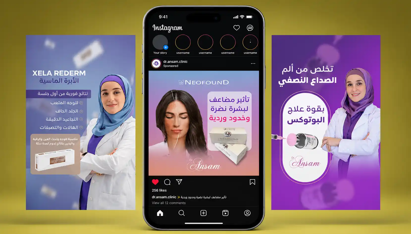 تصميم اعلانات سوشيال ميديا لعيادة تجميل — منشورات وستوري انستقرام بالعربي